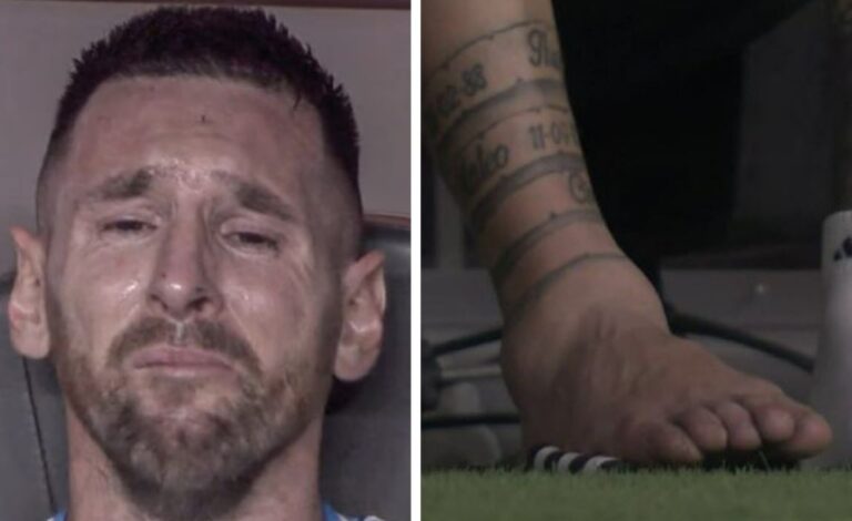 infortunio Messi lacrime